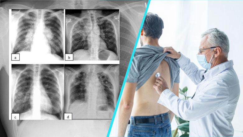 Stil de viață și prevenție recomandări practice pentru gestionare și reducerea riscurilor