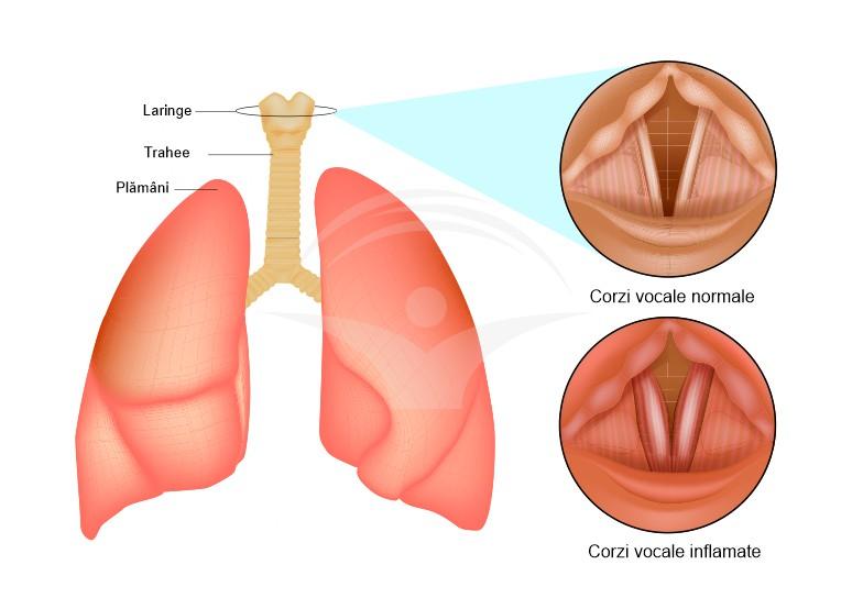 Când să mergi la medic semne de alarmă și situații care necesită evaluare