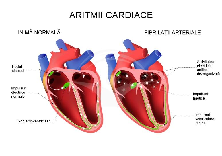 Stil de viață și prevenție pentru sănătatea ritmului cardiac