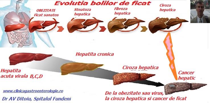 Ce este hepatopatia alcoolică: noțiuni esențiale despre boală
Manifestări clinice frecvente pe care pacienții le pot observa
Cauze principale și factorii care cresc susceptibilitatea
Semnale de alarmă: când să cauți evaluare medicală
Cum se pune diagnosticul: repere esențiale ale evaluării
Opțiuni terapeutice convenționale și obiectivele tratamentului
Intervenții naturiste și complementare: limite și dovezi disponibile
Modificări ale stilului de viață și strategii de prevenție