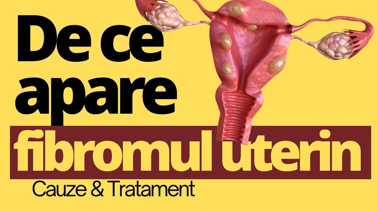 Cauze și factori favorizanți