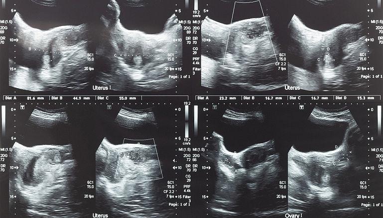 Diagnostic pe scurt
