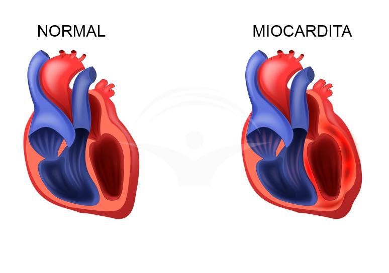 Diagnostic pe scurt