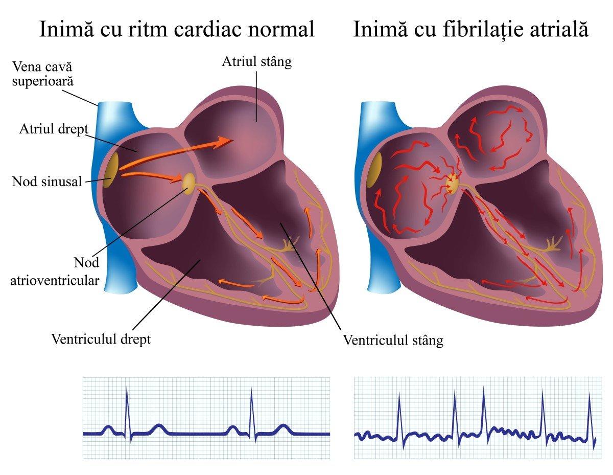 Când să mergi la medic semnale care necesită evaluare promptă