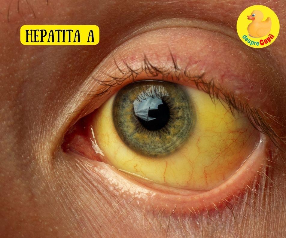Noțiuni esențiale despre hepatita virală
Semne și simptome frecvente la debut și în evoluție
Cauze posibile și factori care pot crește riscul
Când este recomandat să consulți un medic
Cum se stabilește diagnosticul în linii esențiale
Abordări terapeutice medicale uzuale și ce urmăresc acestea
Măsuri naturiste complementare pentru susținerea stării generale
Recomandări practice de stil de viață și prevenție