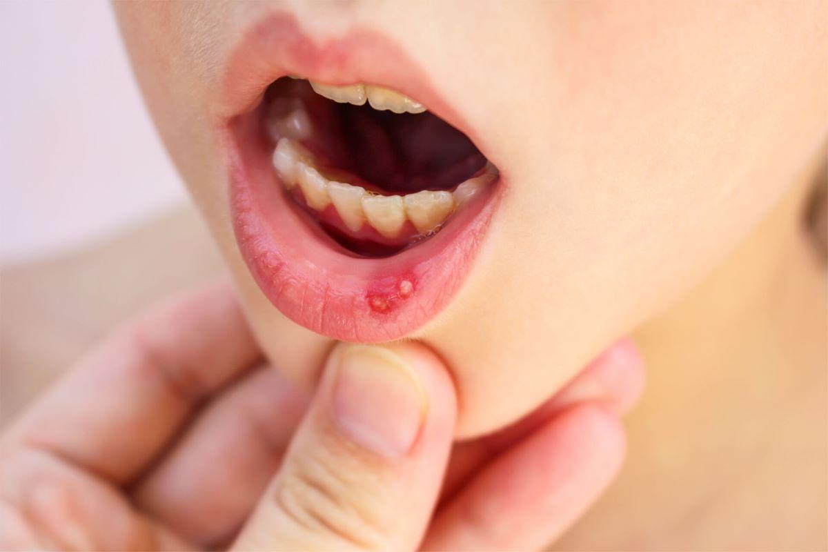 Diagnostic pe scurt