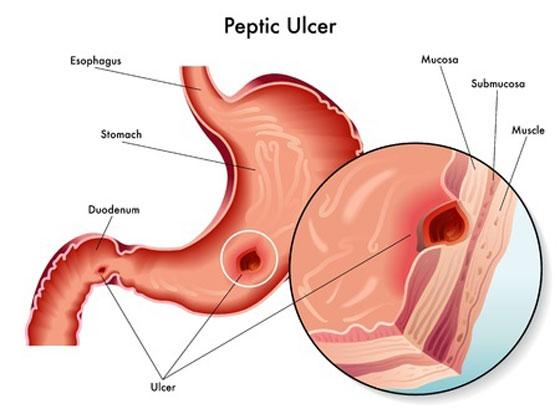 Diagnostic (pe scurt)