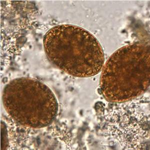 Diagnostic pe scurt al parazitozei intestinale