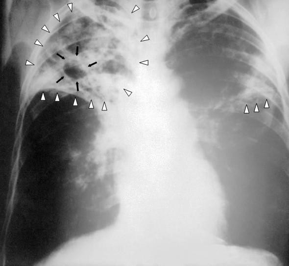 Diagnostic pe scurt