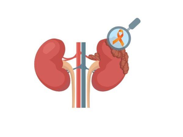 Diagnostic pe scurt și ce implică investigațiile