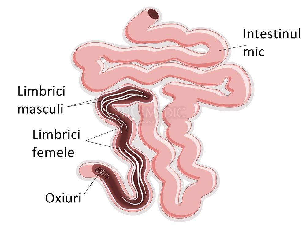 Cauze și factori favorizanți ai parazitozelor intestinale