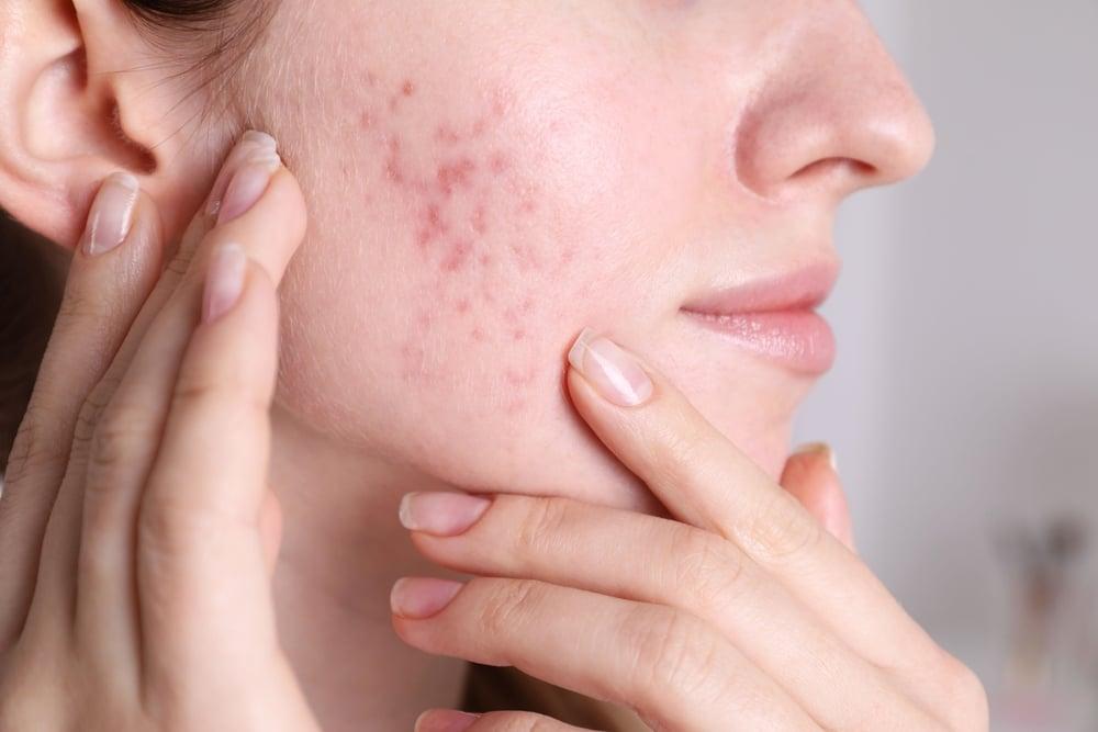 Stil de viață și prevenție măsuri practice pentru gestionare și reducerea riscului