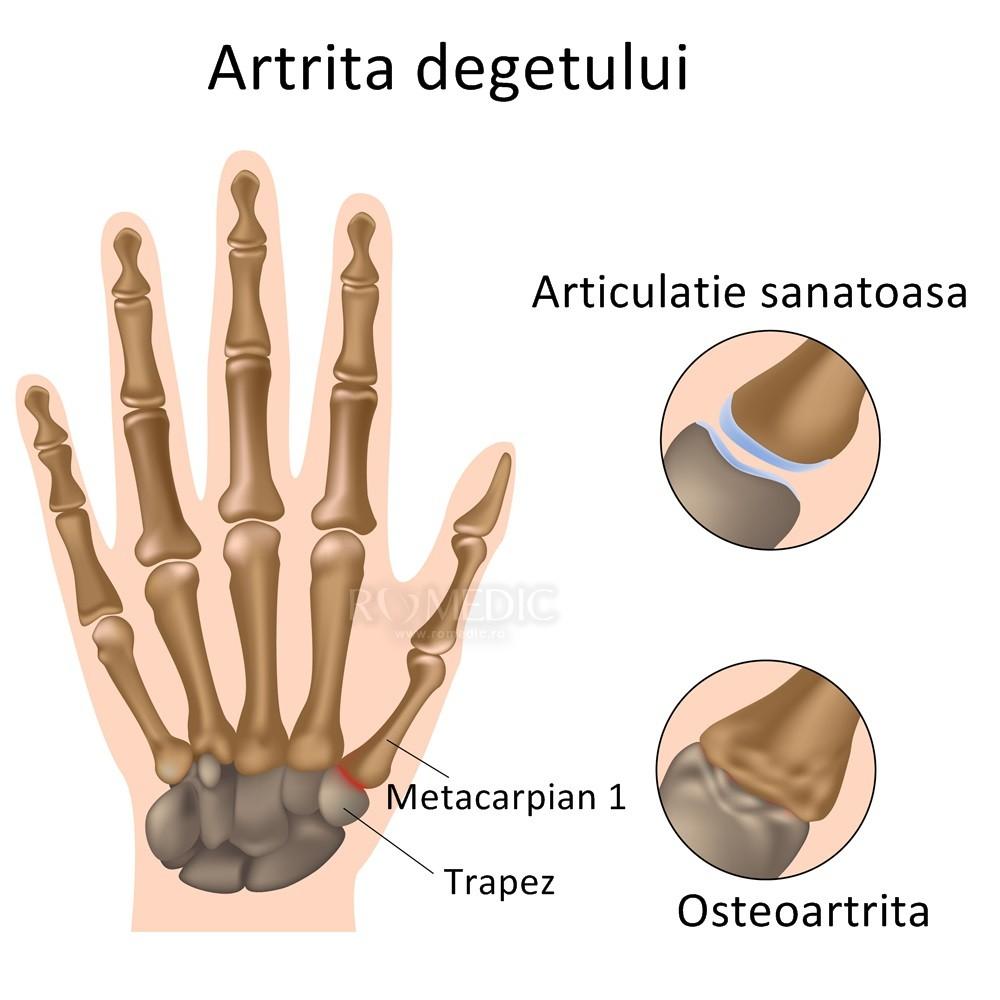 Simptome frecvente