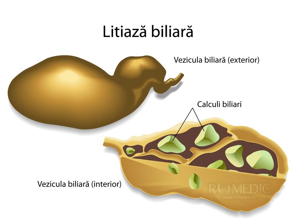 Când să mergi la medic pentru simptome biliare