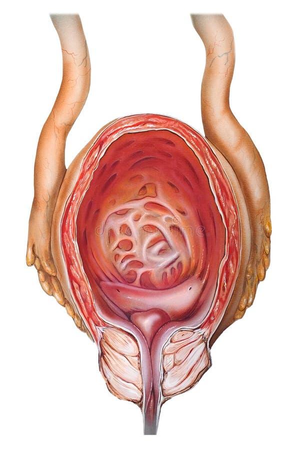 Ce este hipertrofia prostatică explicații esențiale pentru înțelegere