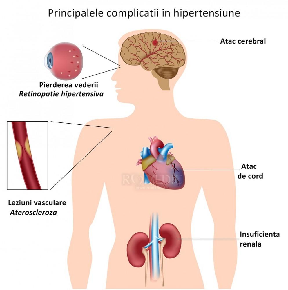 Diagnostic pe scurt investigații uzuale folosite pentru evaluarea afectării cardiace