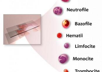 Diagnostic pe scurt