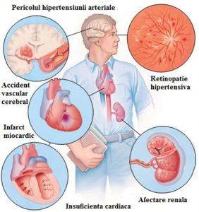 Simptome frecvente ale cardiopatiei hipertensive de care să fii atent