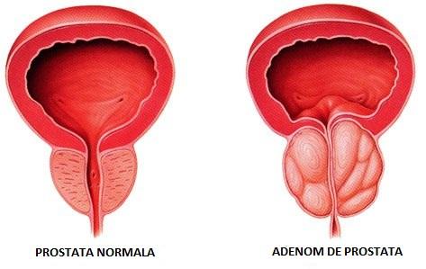 Ce este