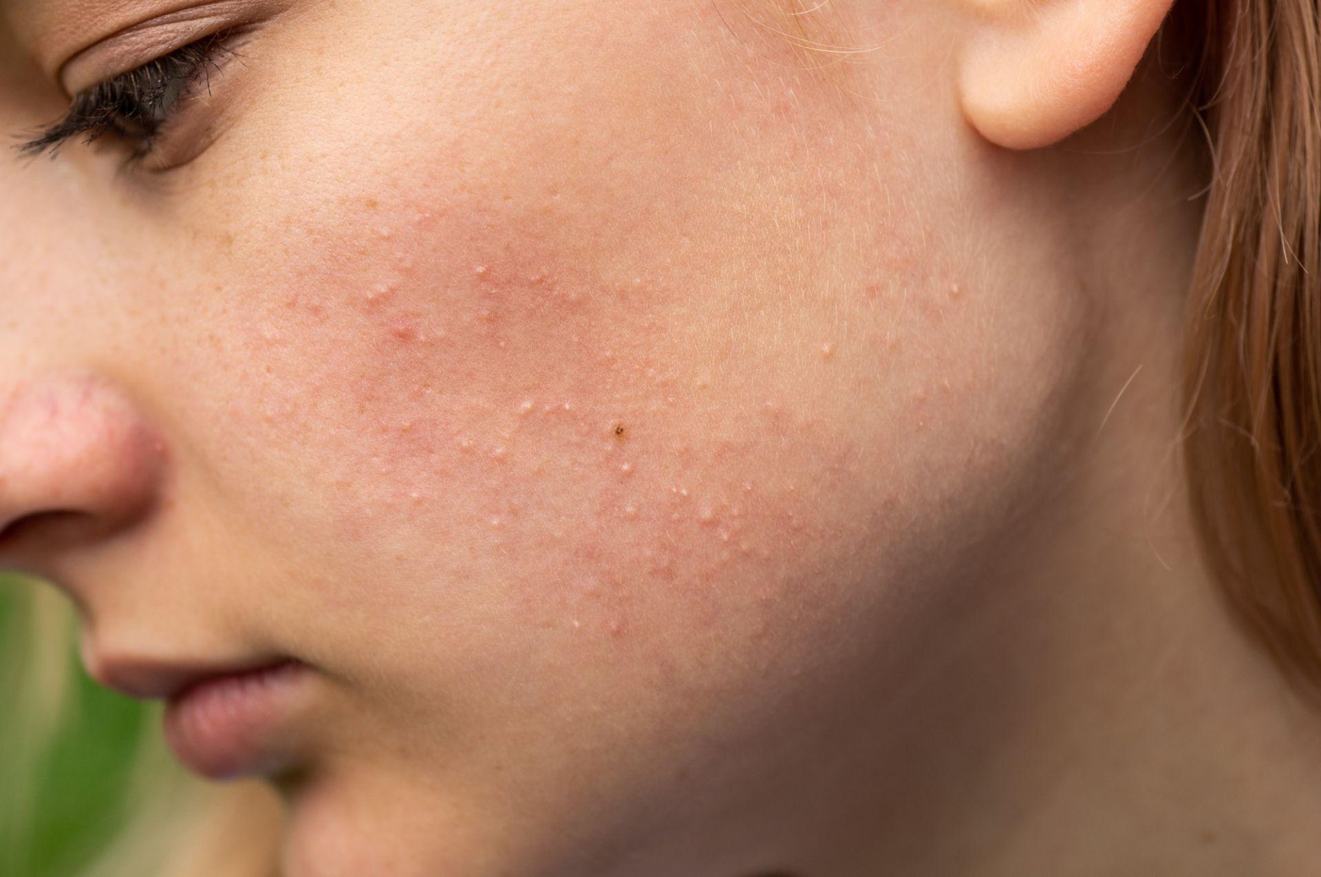 Când să mergi la medic semne de alarmă și motive pentru consult dermatologic