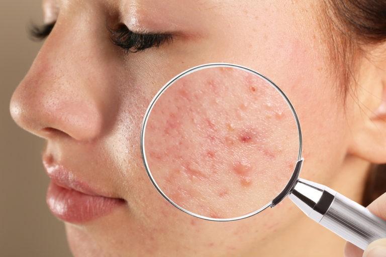 Stil de viață și prevenție măsuri practice pentru gestionare