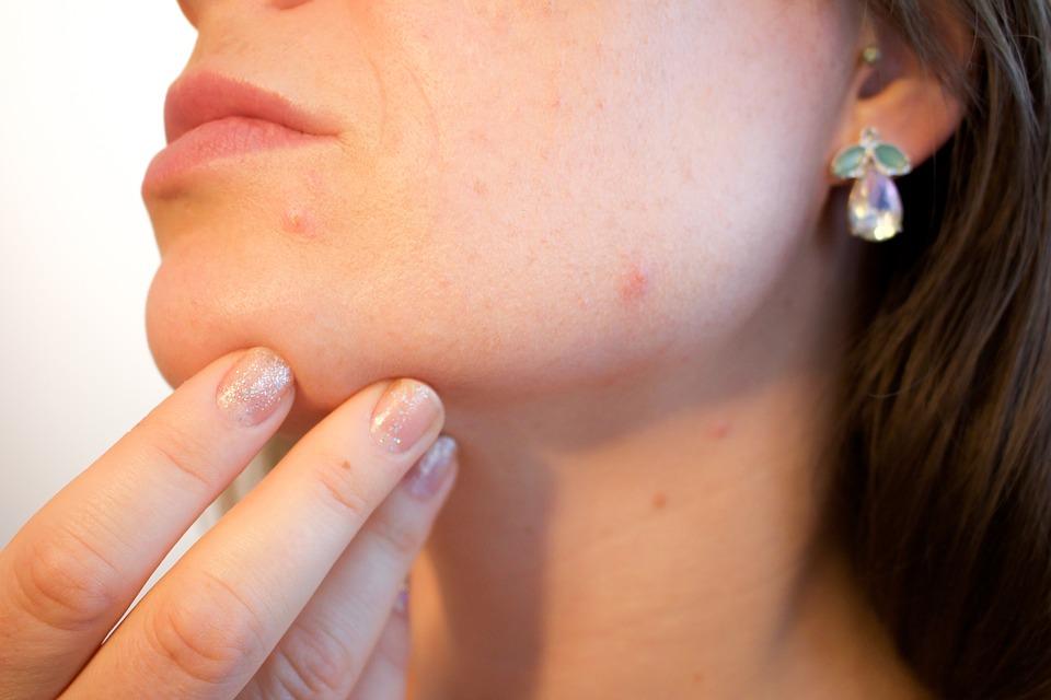 Stil de viață și prevenție recomandări practice pentru îngrijirea pielii și reducerea riscului