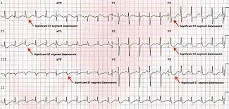 Diagnostic pe scurt