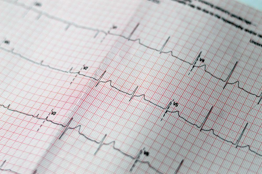 Ce este cardiopatia hipertensivă și cum poate afecta funcția inimii