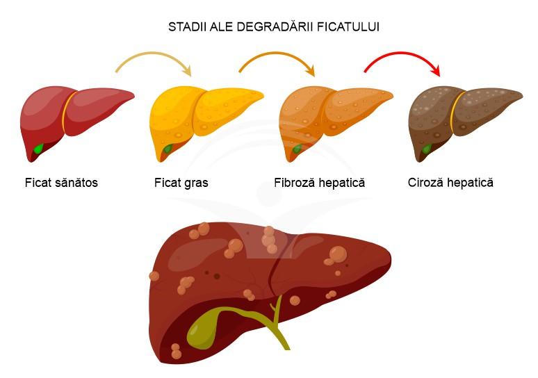 Când să mergi la medic semne care necesită evaluare promptă