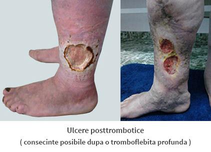 Diagnostic pe scurt