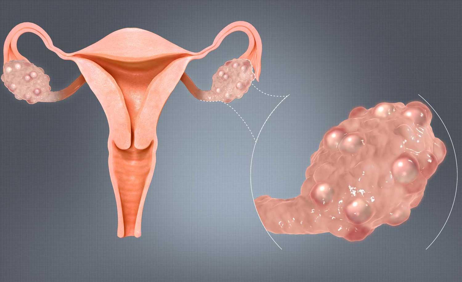 Ce sunt disfuncțiile hormonale la femei
Semne și simptome frecvent întâlnite
Factori declanșatori și elemente de risc
Când este recomandat să consulți un specialist
Cum se evaluează disfuncțiile hormonale în linii generale
Tratamente medicale convenționale și opțiuni de management
Măsuri naturiste și abordări complementare de luat în considerare
Prevenție și ajustări ale stilului de viață pentru sănătatea hormonală