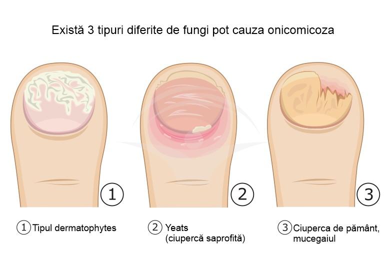 Stil de viață și prevenție