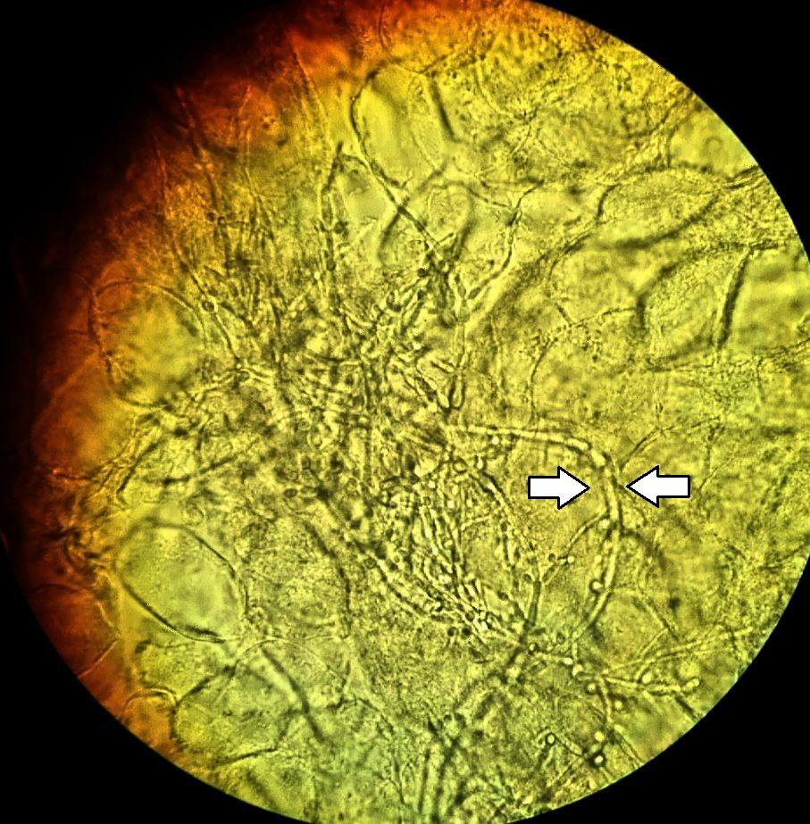 Diagnostic pe scurt