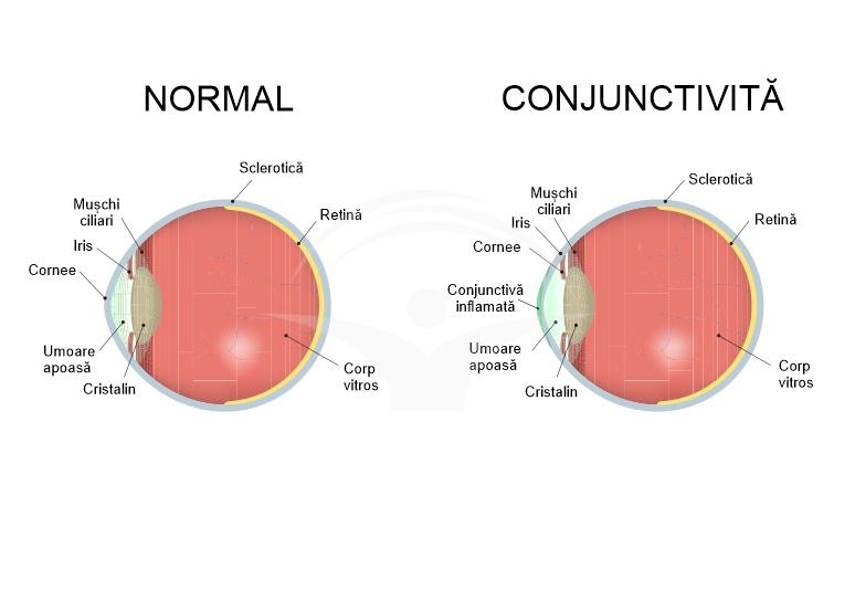 Diagnostic pe scurt