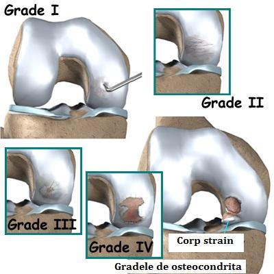 Diagnostic pe scurt