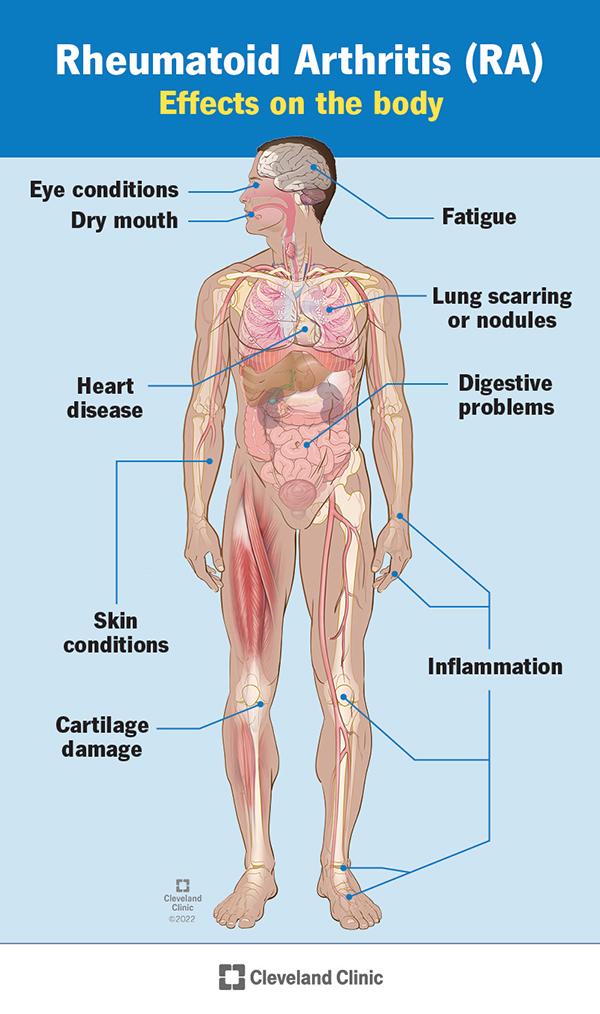 Stil de viață și prevenție recomandări practice pentru gestionare pe termen lung