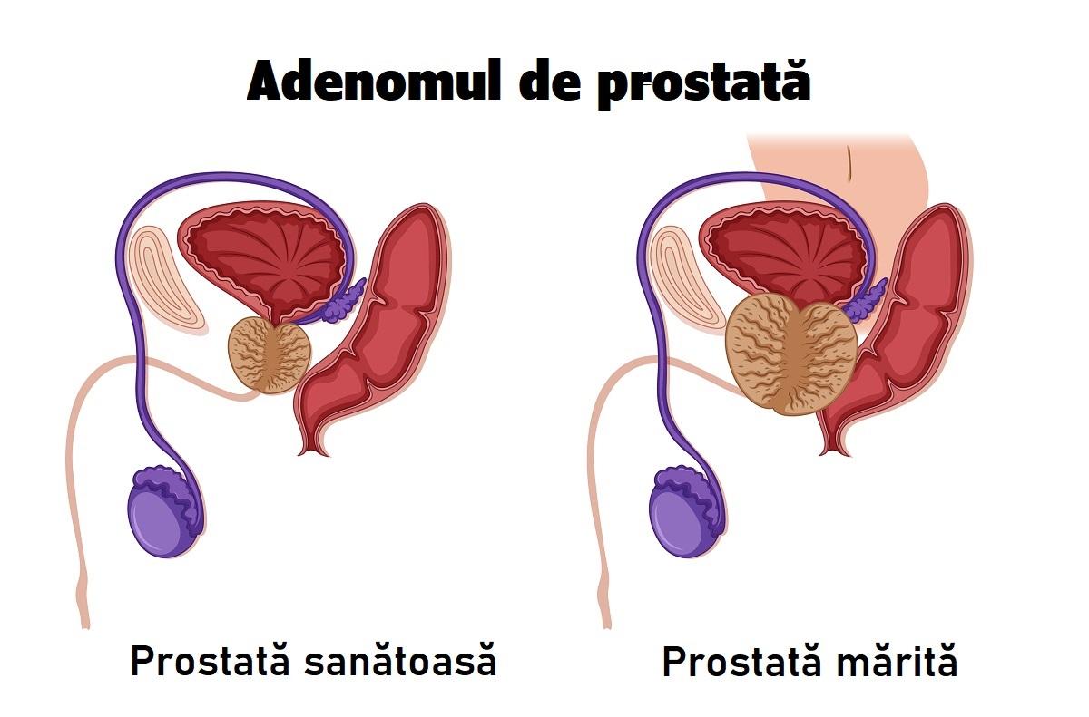 Diagnostic pe scurt