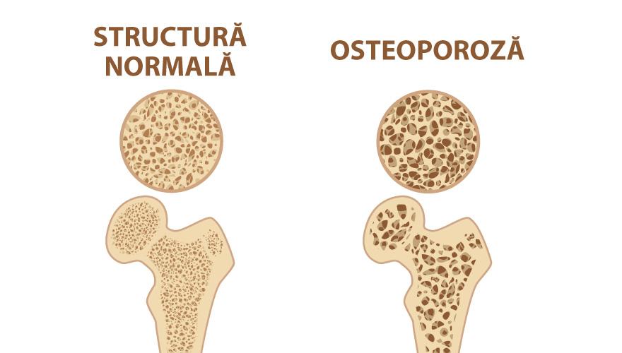 Simptome frecvente