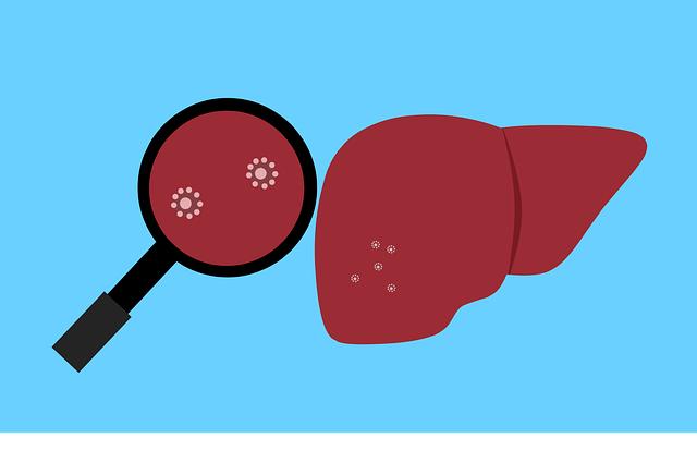 Ce este steatoza hepatică și implicațiile sale