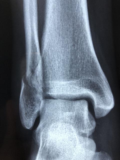 Semne observabile care indică complicații și schimbări ale stilului de viață
