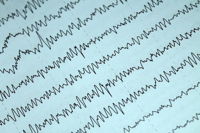 Diagnostic pe scurt pași obișnuiți în evaluarea și monitorizarea epilepsiei